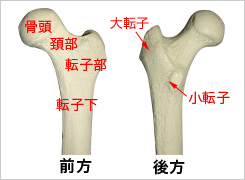 大腿骨近位部