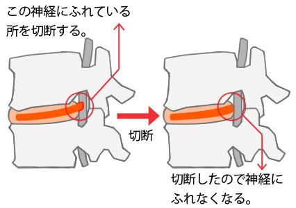 手術例の画像