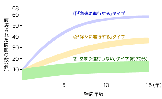 関節リウマチの進行