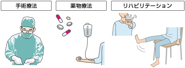 手術療法の目標